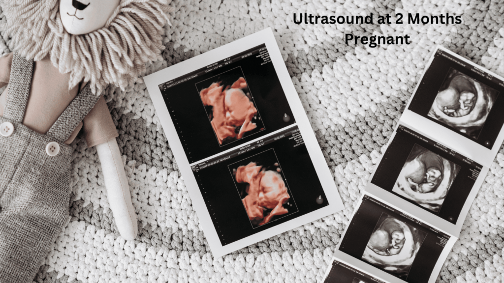 Ultrasound at 2 Months Pregnant